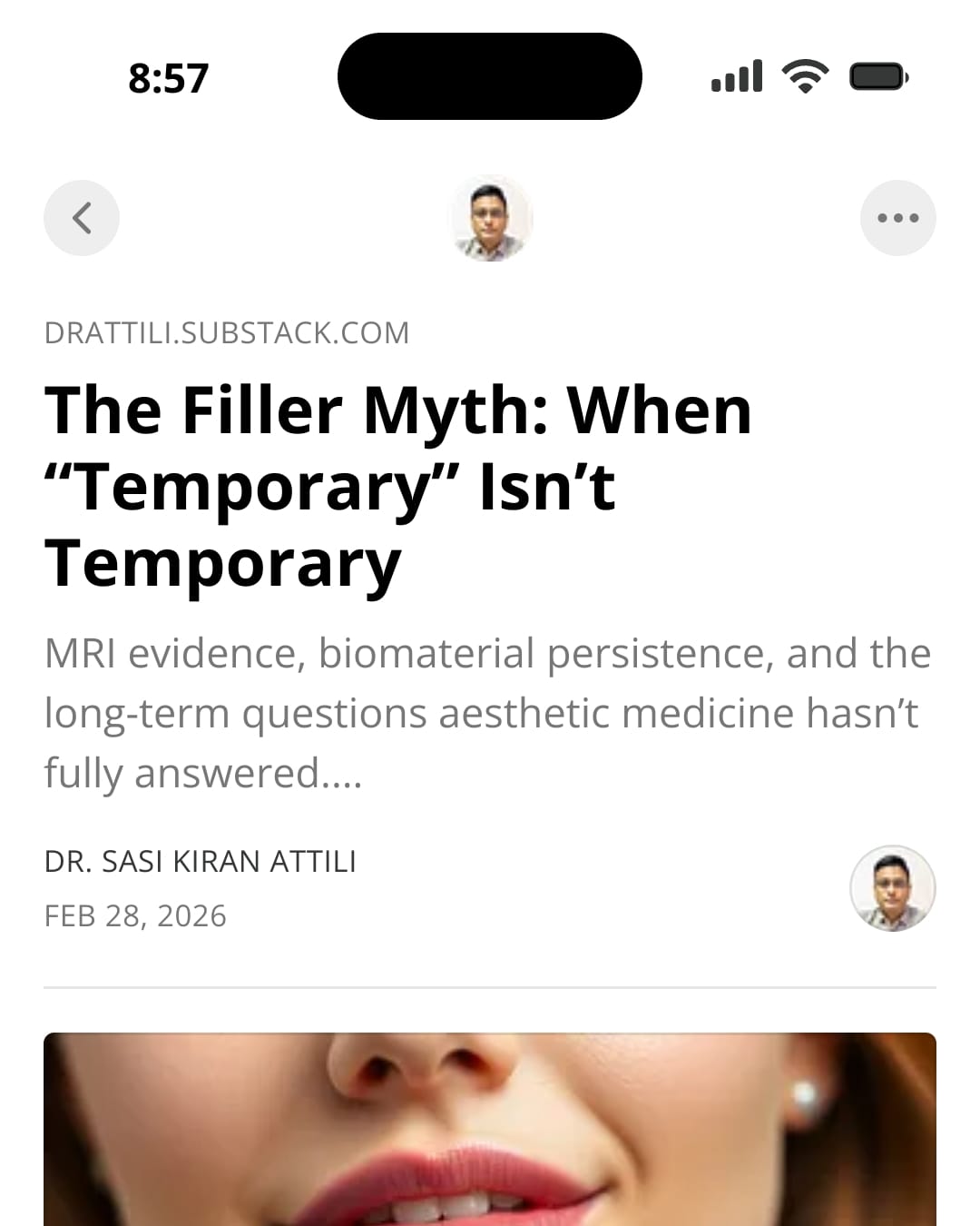 fillers